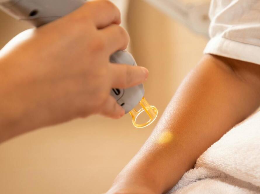 Laser Hair Removal